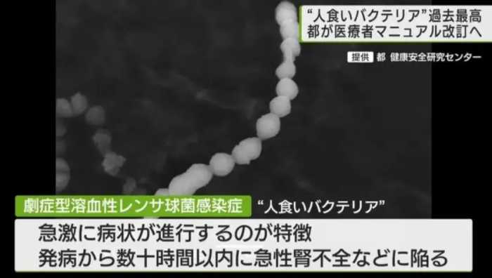 日本“食人菌”爆发，已有上千人被感染，传播速度非常快